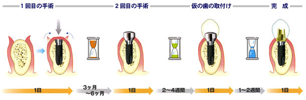 CvgÂ̎菇